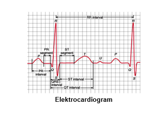publicatie-electrocardiogram